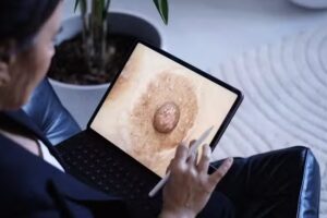 Atelier Duna &ndash; Protesis Silicona Areola/Pezon &ndash; Barcelona