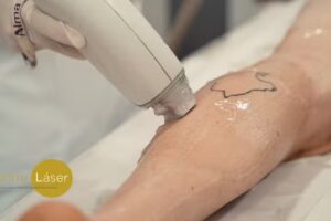 Centre l&aacute;ser Campos