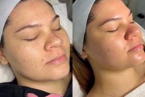 Centro de Depilaci&oacute;n y Est&eacute;tica Oni Esthetic No+vello