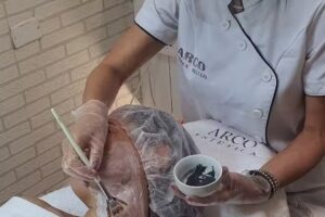 Centro de Estética Arco INGENIO