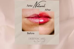 DERMACARE Medicina est&eacute;tica Plasencia