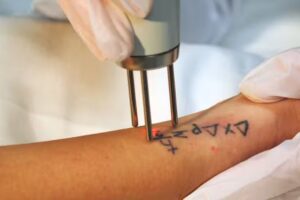 Dermo+Est&eacute;tica O Carballi&ntilde;o