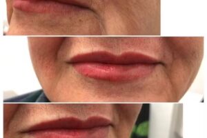 Hermas Beauty Center