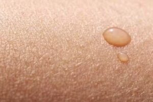 Merc&egrave; Illa &ndash; SkinCare