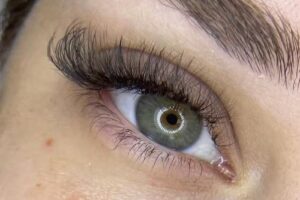 N.E Est&eacute;tica Avanzada