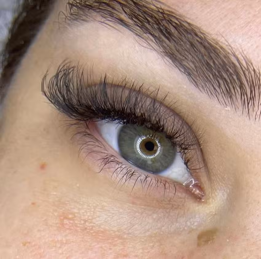 N.E Est&eacute;tica Avanzada