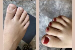 PEDICURA PROFESIONAL ROJALES /Fu&szlig;pflege/Foot Care