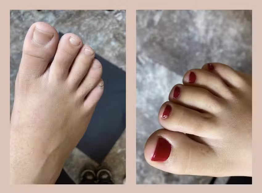 PEDICURA PROFESIONAL ROJALES /Fu&szlig;pflege/Foot Care
