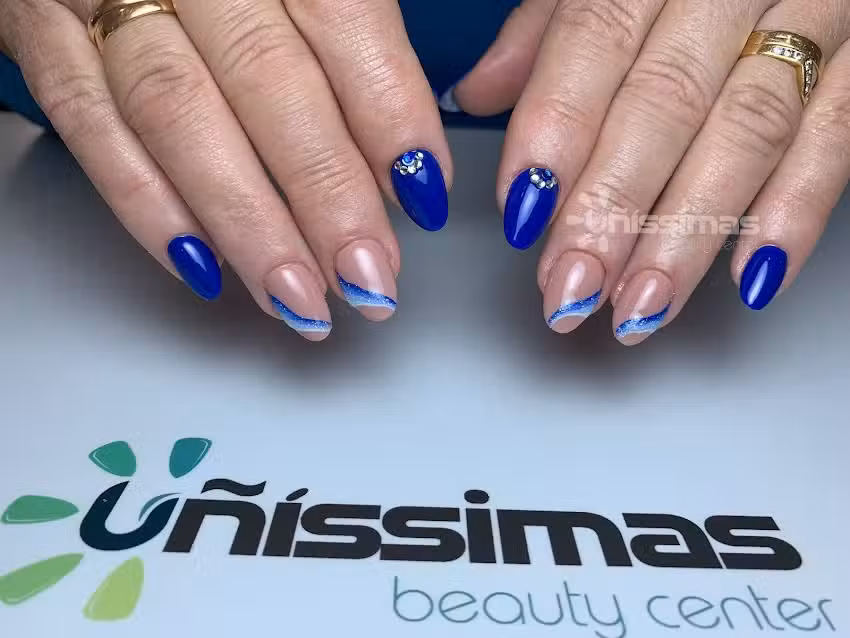 U&ntilde;issimas